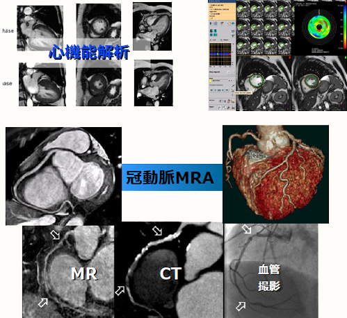 費用 mri 検査